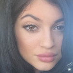 Kylie Jenner Confesses To Lip Fillers