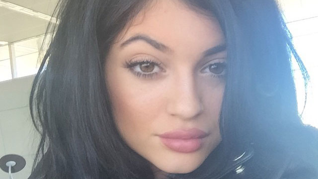 Kylie Jenner Confesses To Lip Fillers